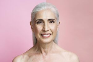 anti-ageing2