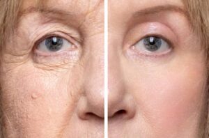 anti-ageing3