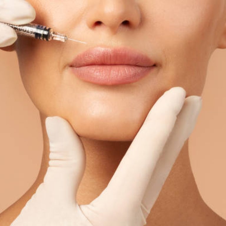 Lip injections concept. Young lady getting beauty injection in her lips, beautician holding syringe with filler next to woman mouth, cropped